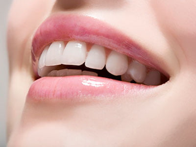 Guided Biofilm Therapy or GBT
